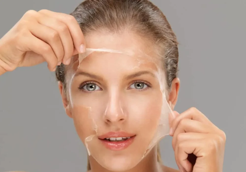 Chemical peels