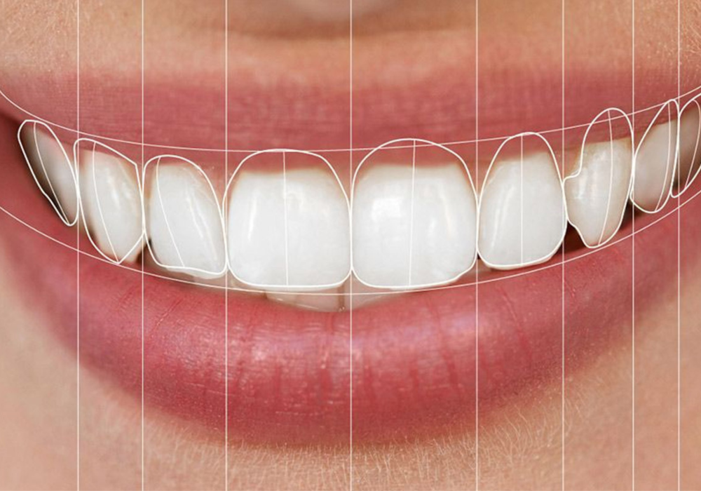 Digital Smile Design