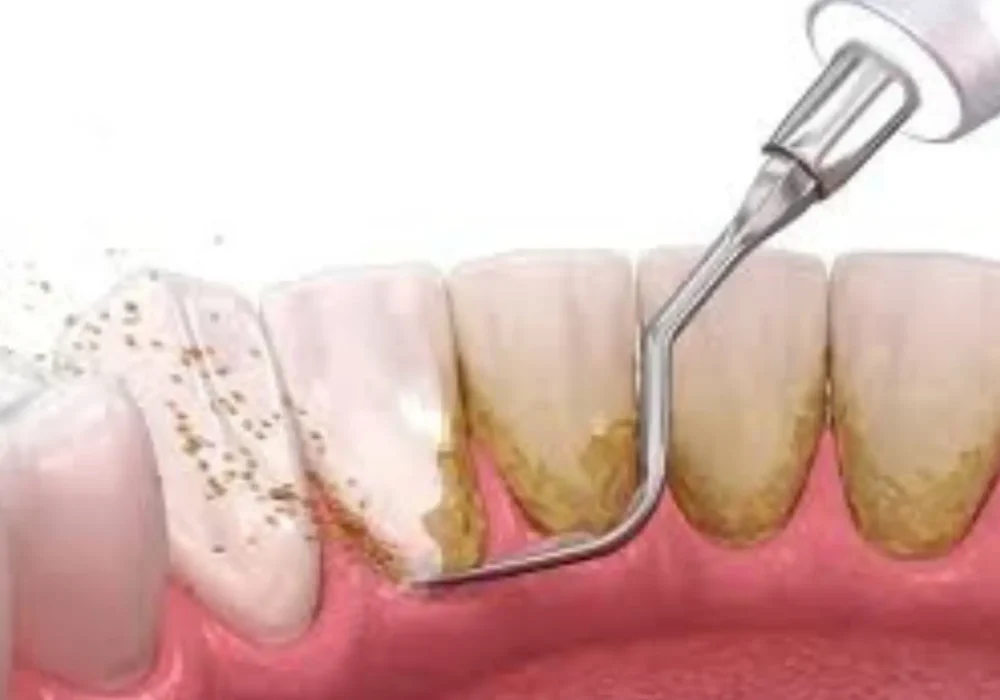 Best Dental Clinic in South Delhi